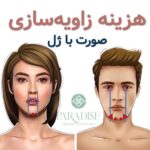 مادلینگ صورت