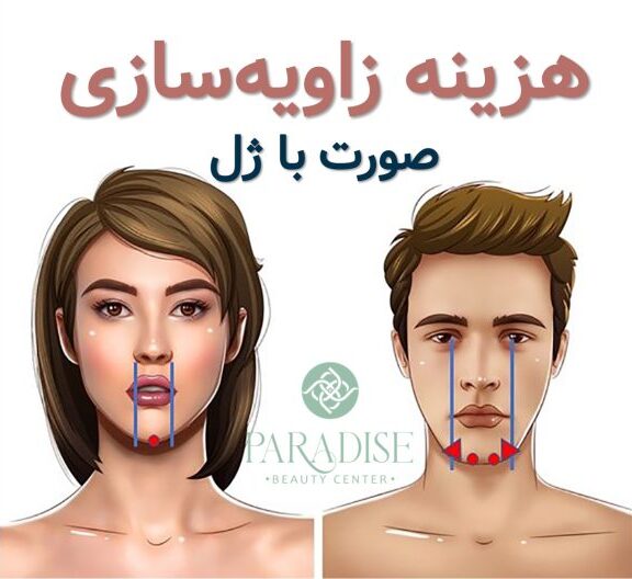 مادلینگ صورت