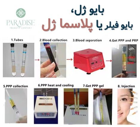 بایوژل، بایو فیلر یا پلاسما ژل