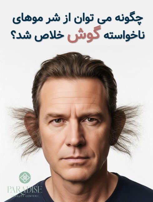 از بین بردن موی زائد گوش