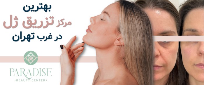 بهترین مرکز تزریق ژل در غرب تهران