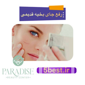 رفع جای بخیه قدیمی