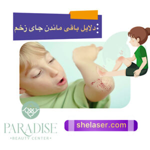 دلایل باقی ماندن جای زخم