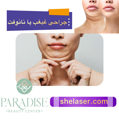 جراحی غبغب یا نانوفت