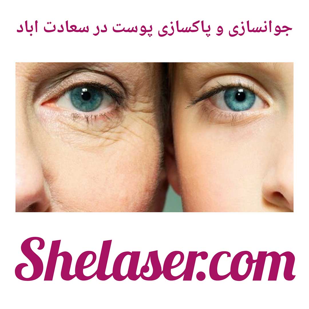 جوانسازی و پاکسازی پوست در سعادت آباد