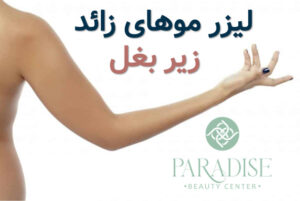 لیزر موهای زائد زیر بغل