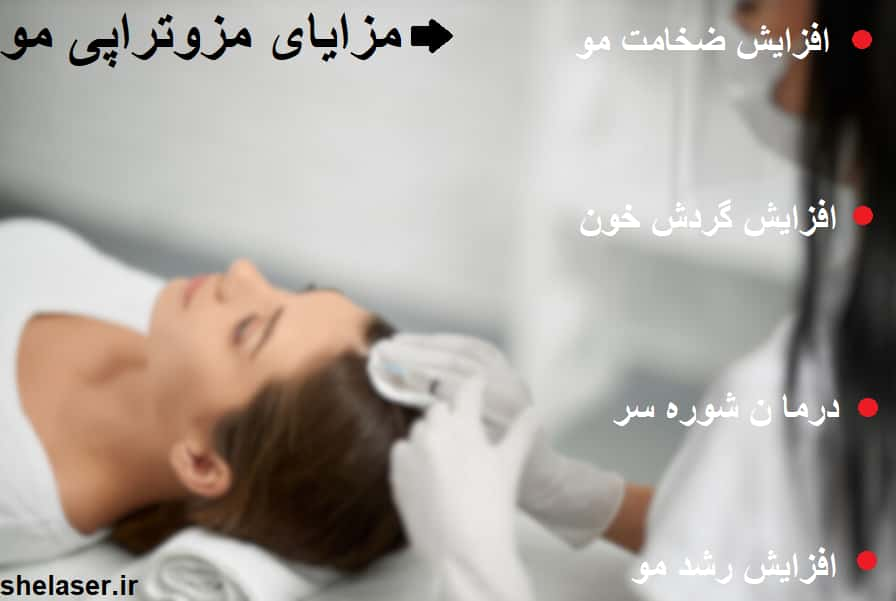 مزایای مزوتراپی مو 