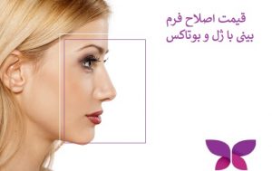 قیمت اصلاح فرم بینی با ژل و بوتاکس