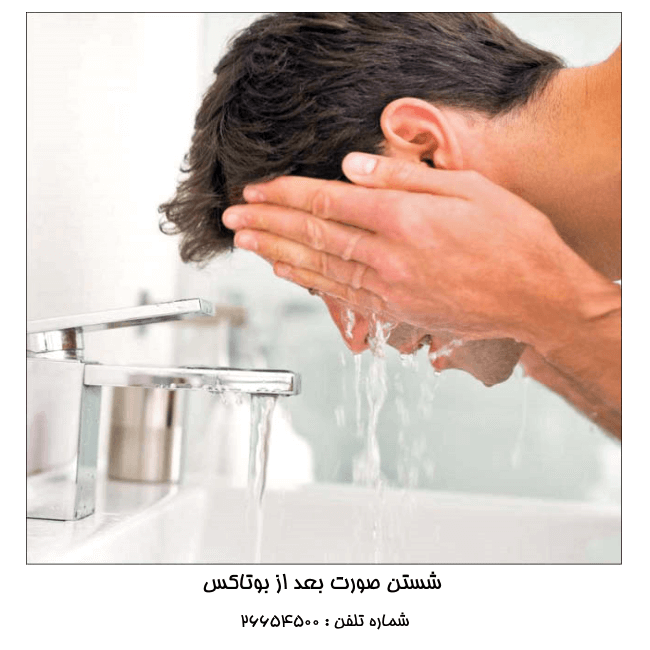 شستن صورت بعد از بوتاکس