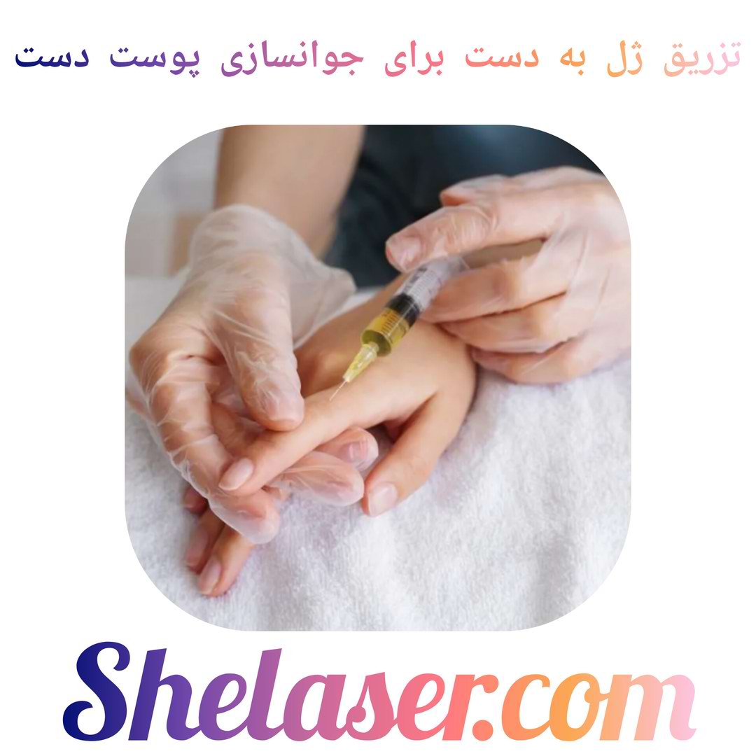 تزریق ژل به دست برای جوانسازی پوست دست