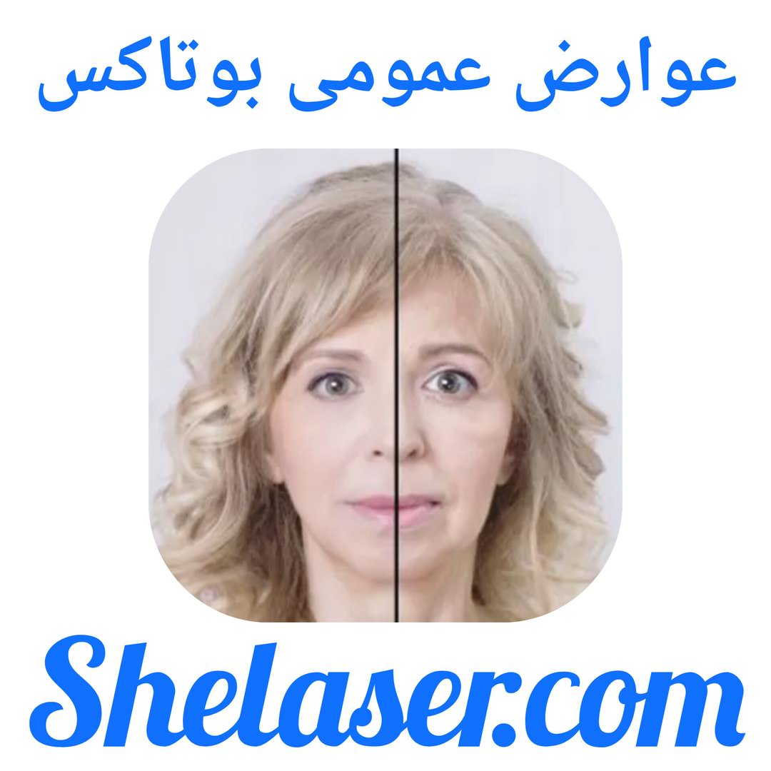 عوارض عمومی بوتاکس