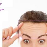 چگونه چین و چروک پیشانی را از بین ببریم؟