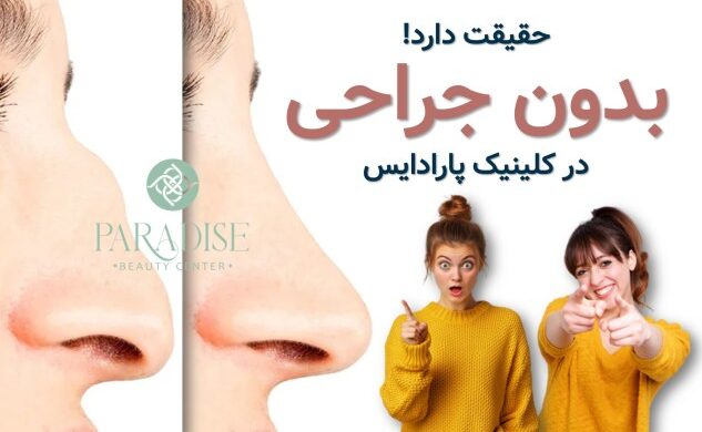 قبل و بعد فیلر بینی