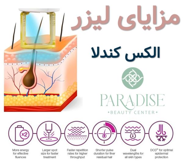 مزایا لیزر موهای زائد مزایا لیزر الکس کندلا