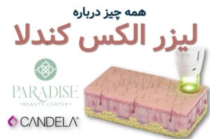 همه چیز درباره لیزر الکس کندلا
