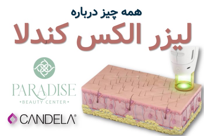 همه چیز درباره لیزر الکس کندلا