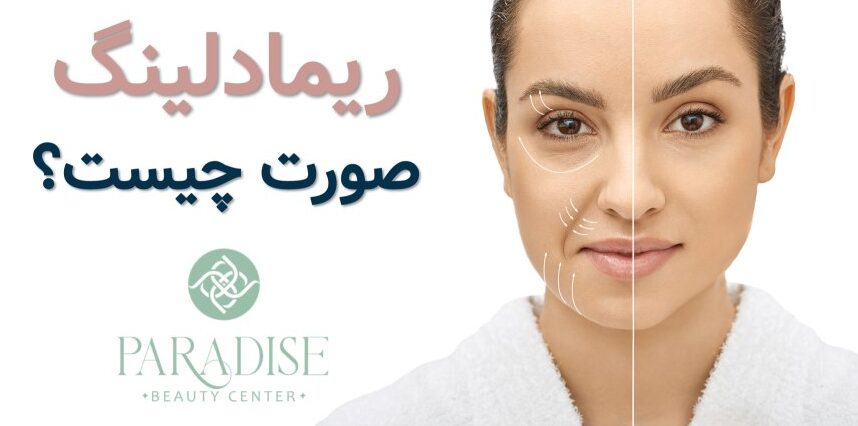 ریمادلینگ چیست؟