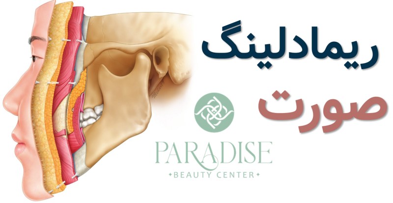 ریمادلینگ صورت