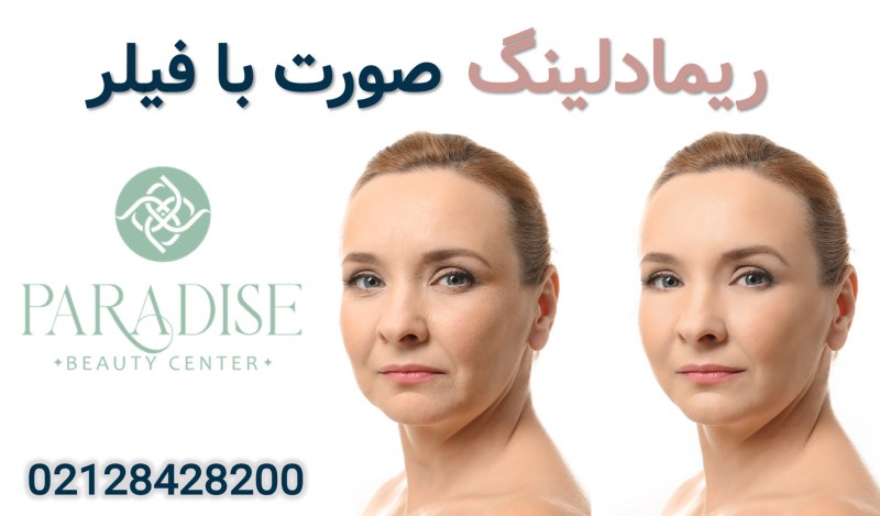 ریمادلینگ صورت با فیلر