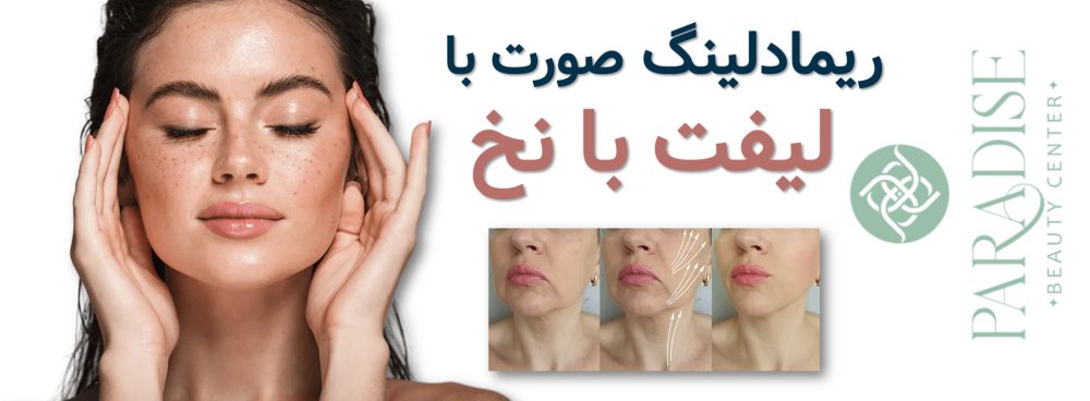 ریمادلینگ صورت با لیفت با نخ