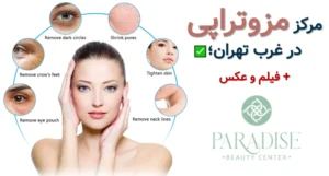 مرکز مزوتراپی در غرب تهران ✅ + فیلم و عکس