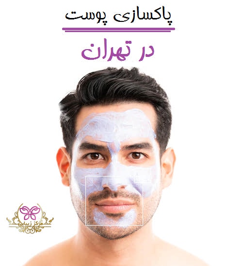 پاکسازی پوست در تهران