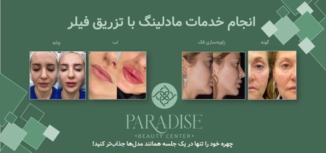 مادلینگ صورت