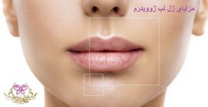 مزایای ژل لب ژوویدرم