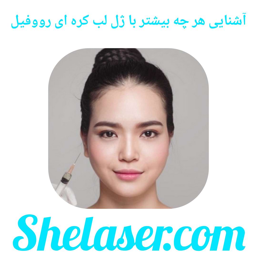 آشنایی هر چه بیشتر با ژل لب کره ای رووفیل