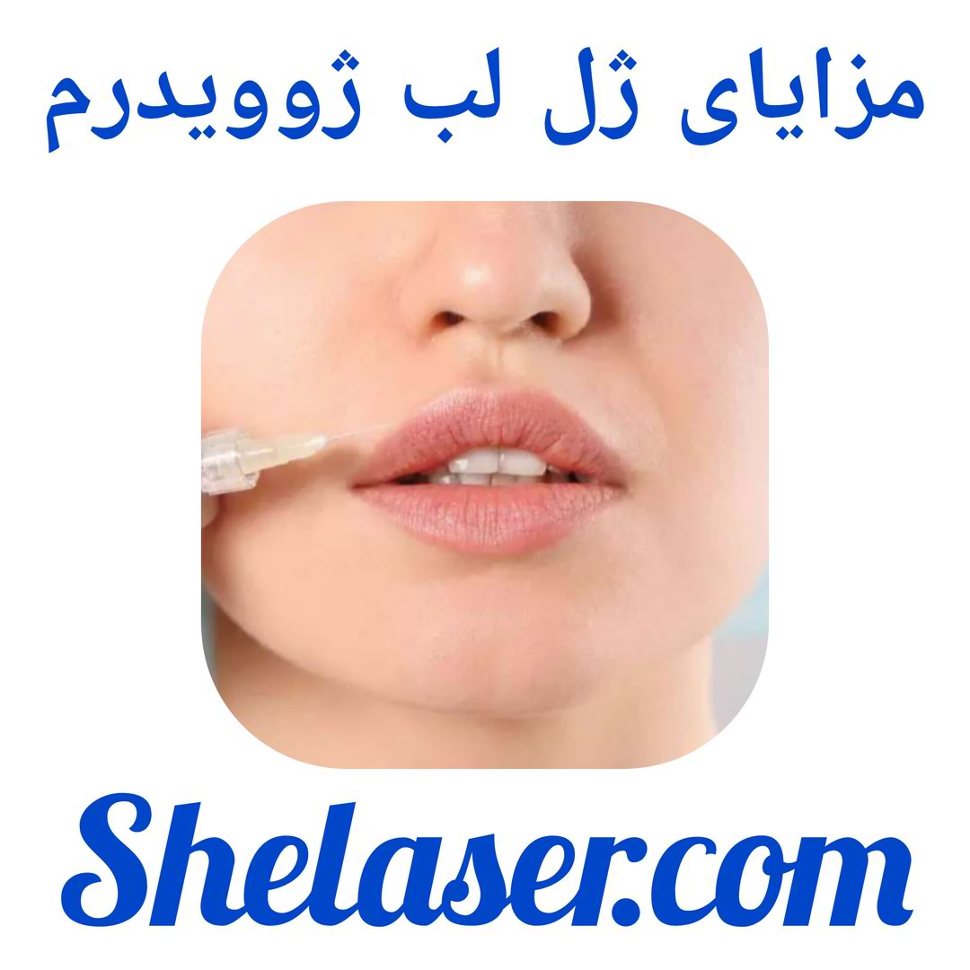 مزایای ژل لب ژوویدرم