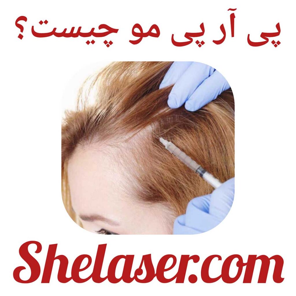 تعداد جلسات پی آر پی