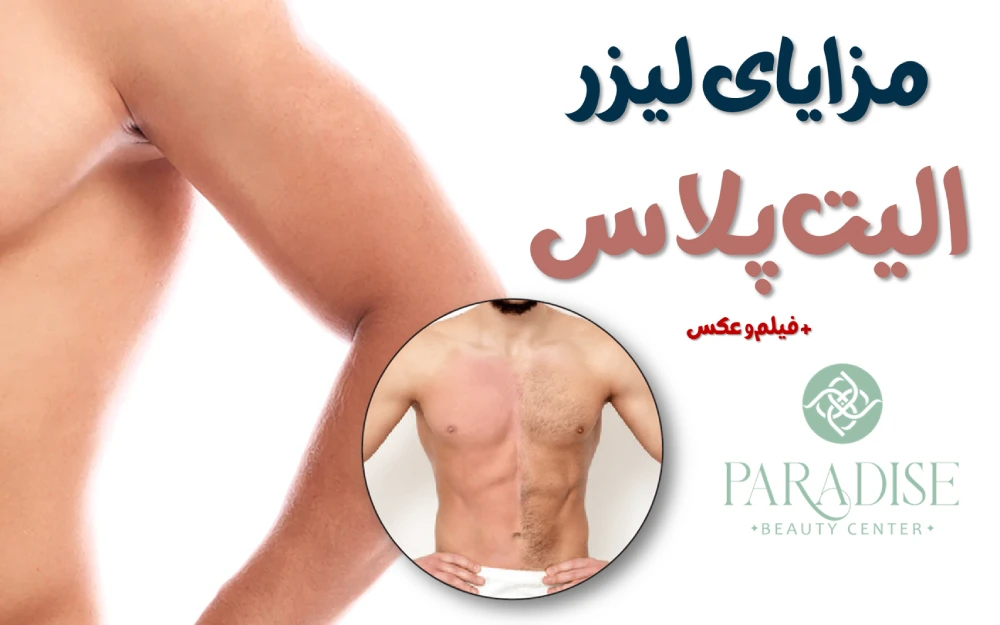 مزایای لیزر الیت پلاس ✅ + فیلم و عکس
