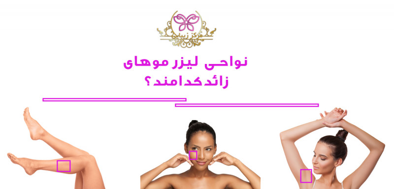 نواحی لیزر مو های زائد کدامند؟