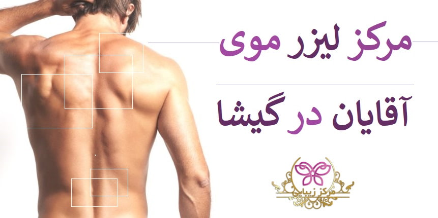 مرکز لیزر موی آقایان در گیشا