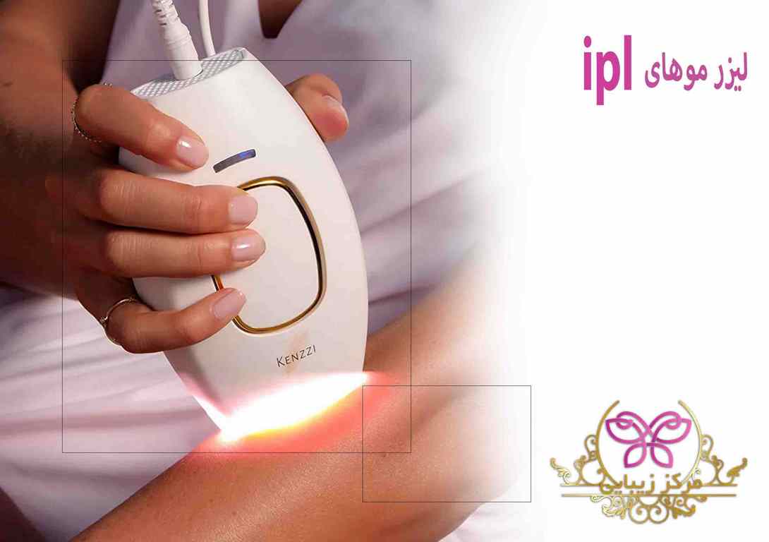 لیزر موهای ipl