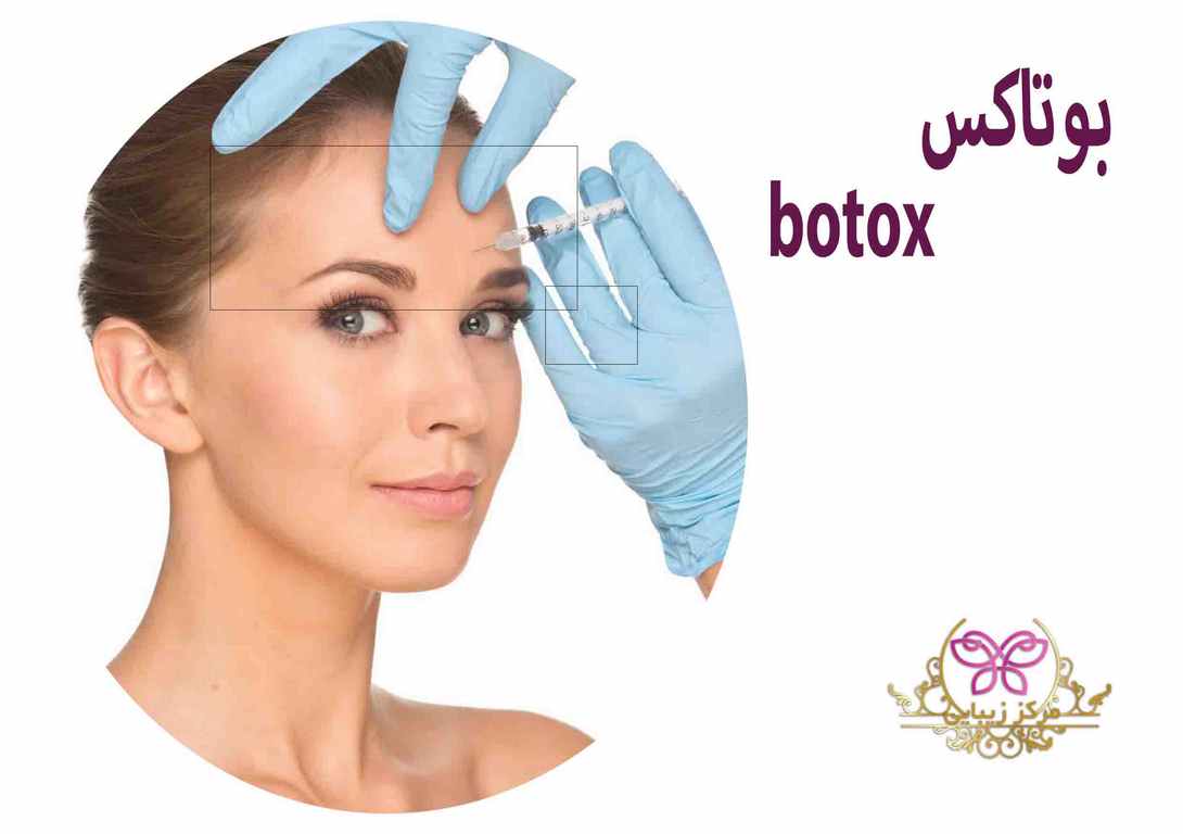 بوتاکس botox