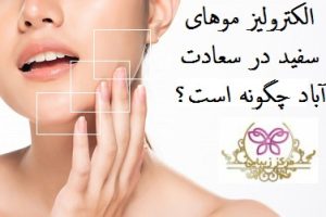 الکترولیز موهای سفید در سعادت اباد چگونه است؟