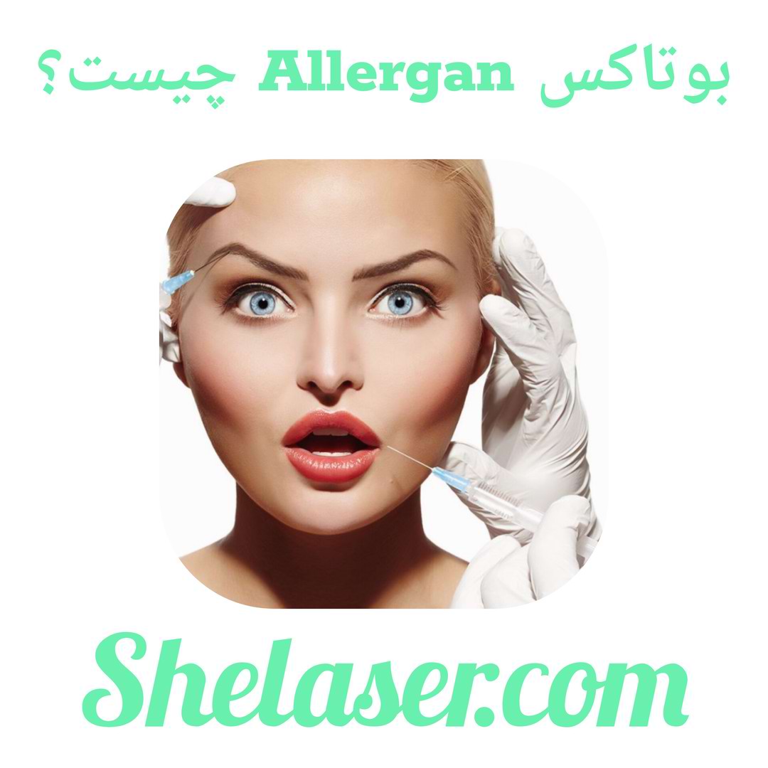 بوتاکس Allergan چیست؟