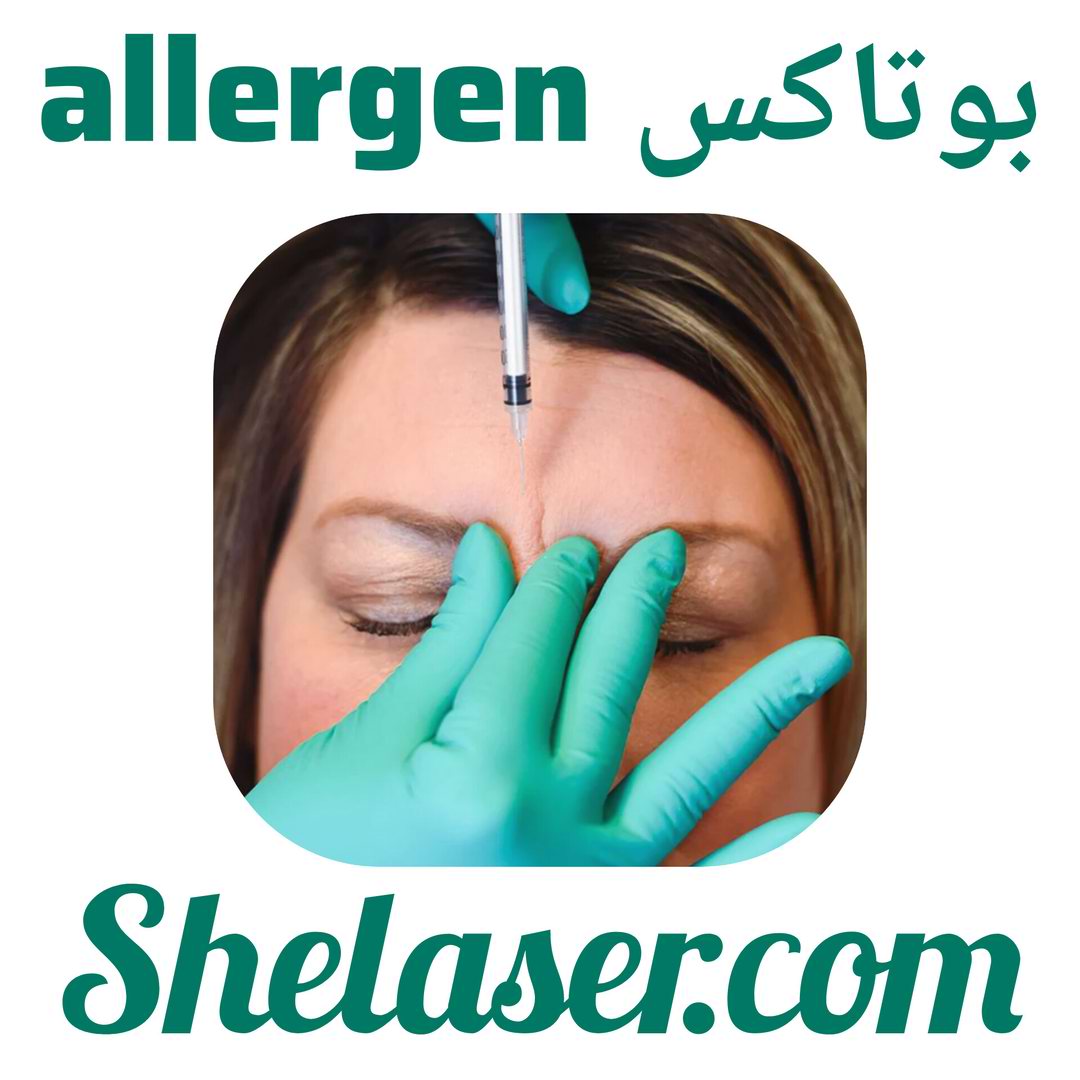 بوتاکس allergen