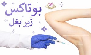 بوتاکس زیر بغل