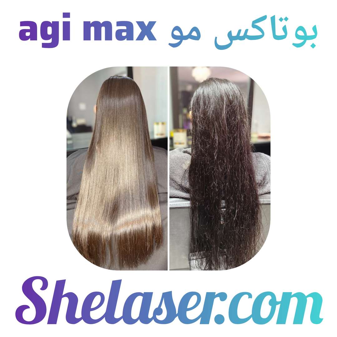 بوتاکس مو agi max