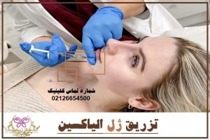 تزریق ژل الیاکسین