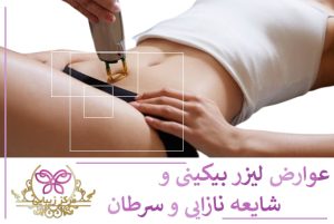 عوارض لیزر بیکینی و شایعه نازایی2