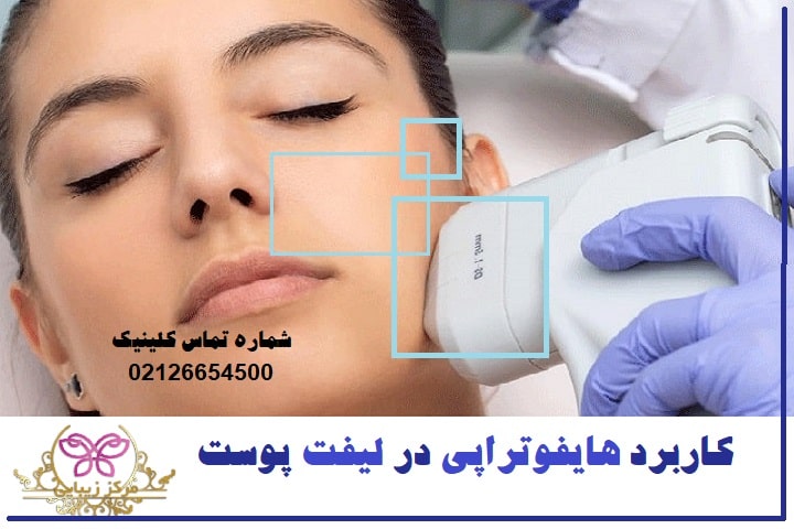 کاربرد هایفوتراپی در لیفت پوست