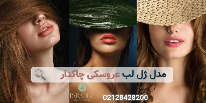 تزریق ژل لب