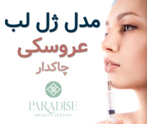 ژل لب عروسکی مدل ژل لب چاکدار