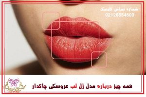 مدل ژل لب عروسکی چاکدار