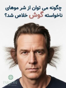 از بین بردن موی زائد گوش