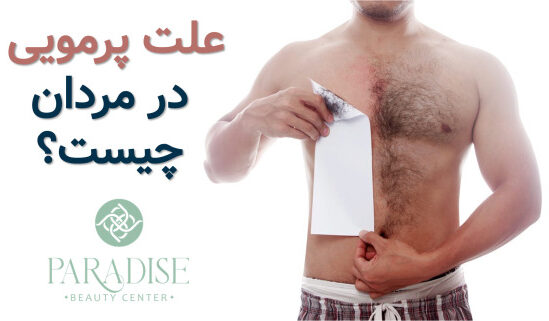 علت پرمویی مردان