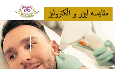 مقایسه لیزر و الکترولیز